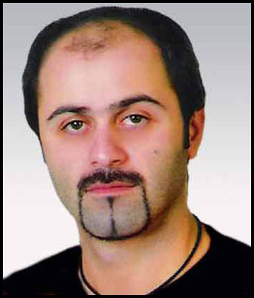 Protez Sa ncesi